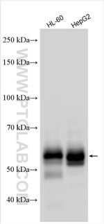 ZFP36L2 Antibody in Western Blot (WB)