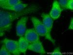 PYCARD Antibody in Immunocytochemistry (ICC/IF)