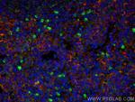 CTLA-4 Antibody in Immunohistochemistry (PFA fixed) (IHC (PFA))