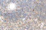 MMP25 Antibody in Immunohistochemistry (Paraffin) (IHC (P))