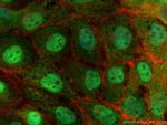 DAPK3 Antibody in Immunocytochemistry (ICC/IF)