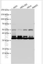 DAPK3 Antibody in Western Blot (WB)