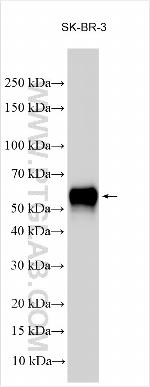 ZBTB7A Antibody in Western Blot (WB)