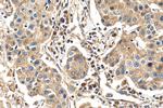 PITRM1 Antibody in Immunohistochemistry (Paraffin) (IHC (P))
