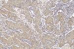 PITRM1 Antibody in Immunohistochemistry (Paraffin) (IHC (P))