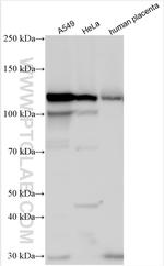 PITRM1 Antibody in Western Blot (WB)