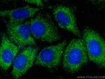 Lipoprotein(a) Antibody in Immunocytochemistry (ICC/IF)