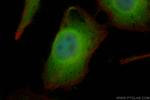 CLOCK Antibody in Immunocytochemistry (ICC/IF)