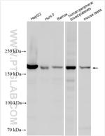 IQGAP2 Antibody in Western Blot (WB)