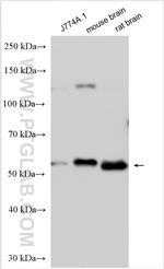 DFNA5/GSDME Antibody in Western Blot (WB)