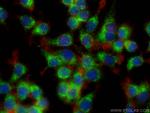 NGAL Antibody in Immunocytochemistry (ICC/IF)