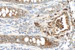 NGAL Antibody in Immunohistochemistry (Paraffin) (IHC (P))