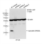 NGAL Antibody in Western Blot (WB)