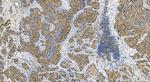 SMC2 Antibody in Immunohistochemistry (Paraffin) (IHC (P))