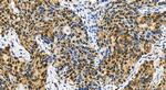 SMC2 Antibody in Immunohistochemistry (Paraffin) (IHC (P))