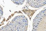 PDE8B Antibody in Immunohistochemistry (Paraffin) (IHC (P))