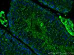 PDE8B Antibody in Immunohistochemistry (PFA fixed) (IHC (PFA))