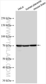 PDE8B Antibody in Western Blot (WB)