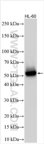 SUSD2 Antibody in Western Blot (WB)