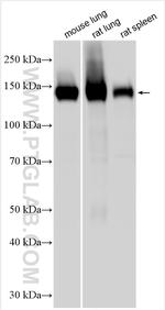 Integrin alpha-8 Antibody in Western Blot (WB)