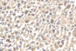 MGAT4B Antibody in Immunohistochemistry (Paraffin) (IHC (P))