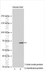 MGAT4B Antibody in Western Blot (WB)