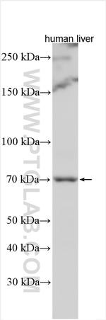 MGAT4B Antibody in Western Blot (WB)