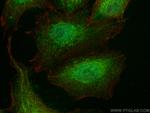 LHX8 Antibody in Immunocytochemistry (ICC/IF)