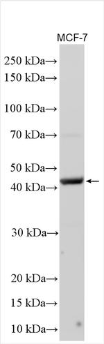 LHX8 Antibody in Western Blot (WB)
