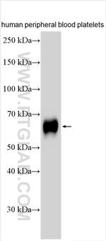 CD226 Antibody in Western Blot (WB)