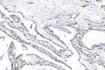 Endoglin/CD105 Antibody in Immunohistochemistry (Paraffin) (IHC (P))
