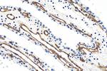 Endoglin/CD105 Antibody in Immunohistochemistry (Paraffin) (IHC (P))