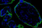 Endoglin/CD105 Antibody in Immunohistochemistry (PFA fixed) (IHC (PFA))