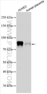 Endoglin/CD105 Antibody in Western Blot (WB)