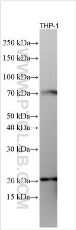 RNASE4 Antibody in Western Blot (WB)