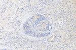 FAT1 Antibody in Immunohistochemistry (Paraffin) (IHC (P))