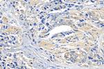 FAT1 Antibody in Immunohistochemistry (Paraffin) (IHC (P))