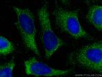 TIMP1 Antibody in Immunocytochemistry (ICC/IF)