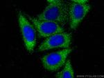 TIMP1 Antibody in Immunocytochemistry (ICC/IF)