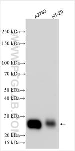 TIMP1 Antibody in Western Blot (WB)
