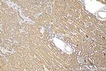 GPAT3 Antibody in Immunohistochemistry (Paraffin) (IHC (P))