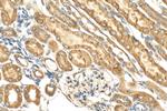 GPAT3 Antibody in Immunohistochemistry (Paraffin) (IHC (P))