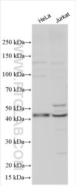 GPAT3 Antibody in Western Blot (WB)