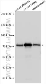 EPOR Antibody in Western Blot (WB)