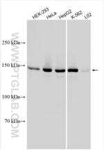 KIF15 Antibody in Western Blot (WB)