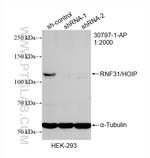 RNF31/HOIP Antibody in Western Blot (WB)