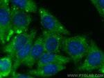 MMP1 Antibody in Immunocytochemistry (ICC/IF)