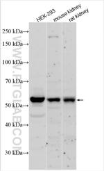 MMP1 Antibody in Western Blot (WB)
