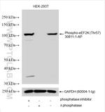 Phospho-eEF2K (Thr57) Antibody in Western Blot (WB)