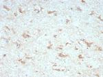 KCNIP2/KCHIP2 Monoclonal Antibody (KCNIP2/7589)